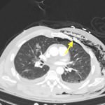 Creative Commons images