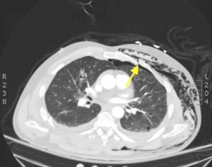 Creative Commons images