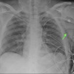 Creative Commons images