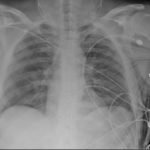 Creative Commons images