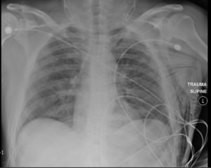 Creative Commons images