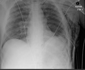 Creative Commons images