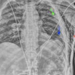 Creative Commons images