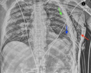 Creative Commons images