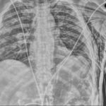 Creative Commons images