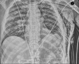 Creative Commons images