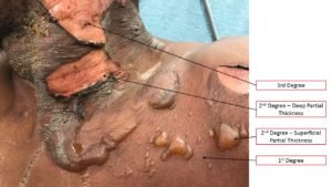 Creative Commons images