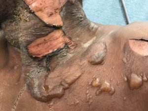 Creative Commons images