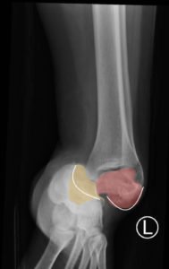 Creative Commons images