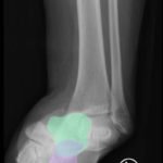 Creative Commons images