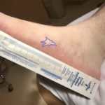 Lightning Ground Current Injury: A Subtle Shocker 1 Creative Commons images