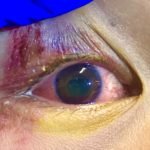 Creative Commons images