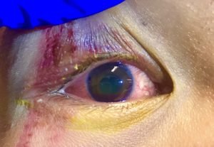 Creative Commons images