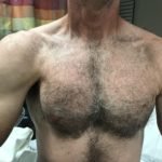 Pectoralis Muscle Tendon Rupture 1 Creative Commons images