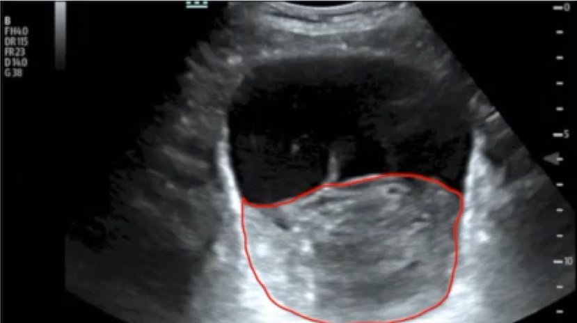 Creative Commons images