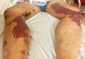 Creative Commons images