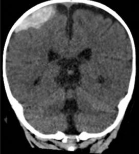 Creative Commons images