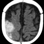 Creative Commons images