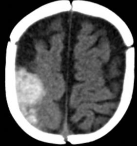 Creative Commons images