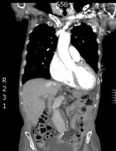 Creative Commons images