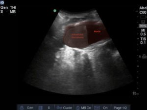 Creative Commons images