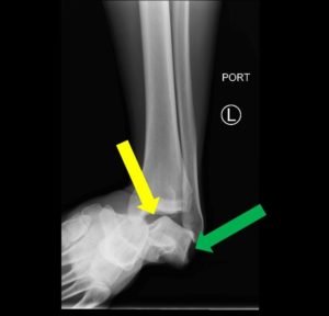 Creative Commons images