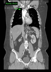 Creative Commons images