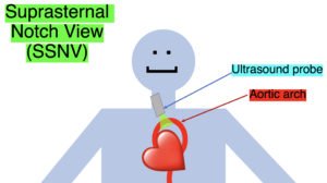 Creative Commons images