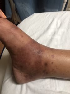 Creative Commons images