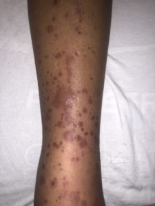 Creative Commons images