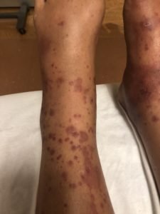 Creative Commons images