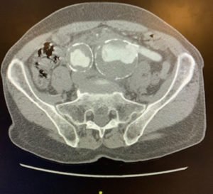 Creative Commons images