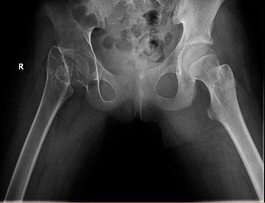 Creative Commons images