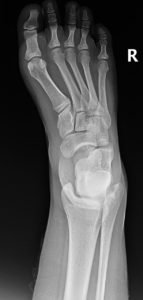 Creative Commons images