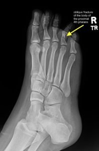 Creative Commons images