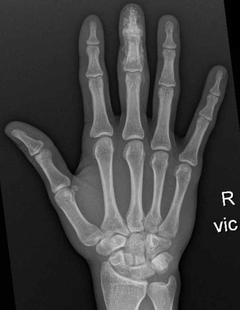 Creative Commons images