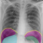 Creative Commons images