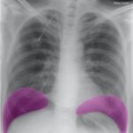 Creative Commons images