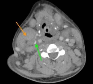 Creative Commons images