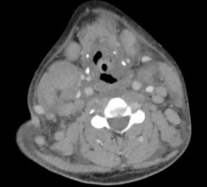 Creative Commons images