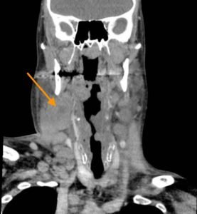 Creative Commons images