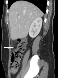 Creative Commons images