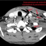 Creative Commons images