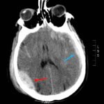 Creative Commons images