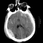 Creative Commons images