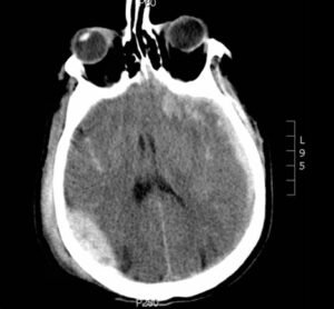 Creative Commons images