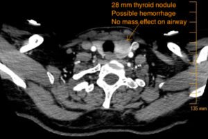 Creative Commons images