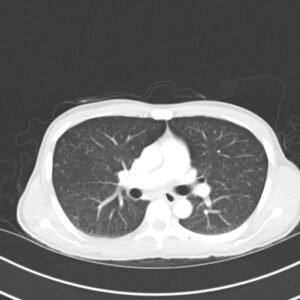 Creative Commons images