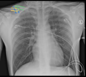 Creative Commons images