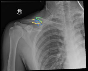 Creative Commons images